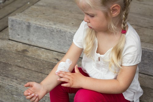Young girl applying steroid cream to eczema on her arm