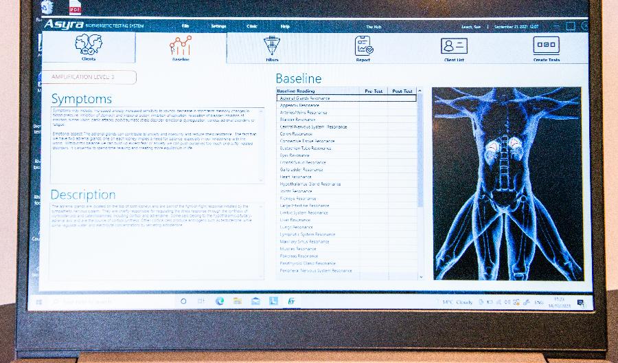 Bioresonance testing